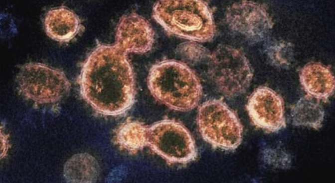 Kemenkes Pelajari Virus Baru Langya yang Ditemukan di China, Ini Cirinya...